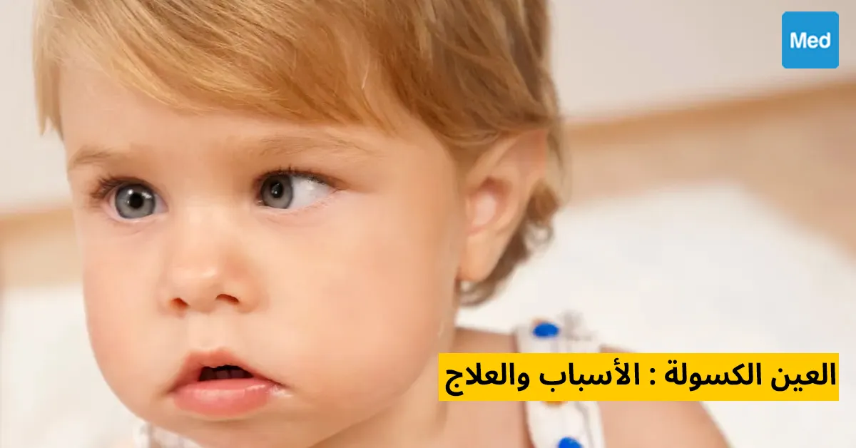 العين الكسولة : الأسباب والعلاج